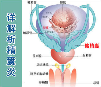 精囊炎